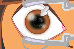 朵拉眼睛手术
